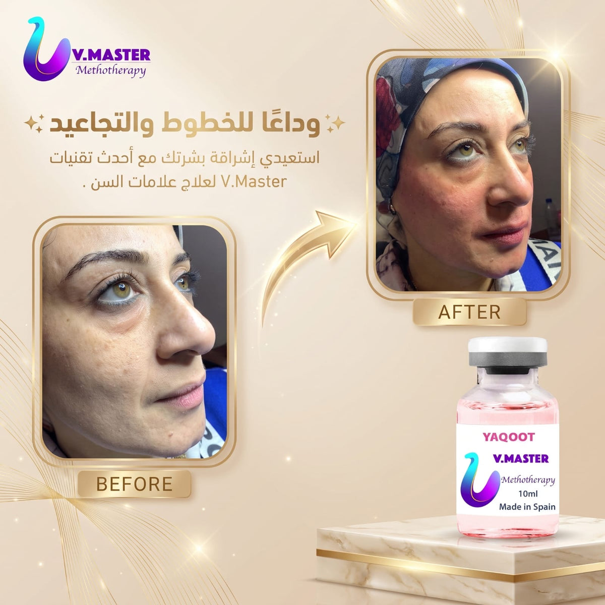 YAQOOT