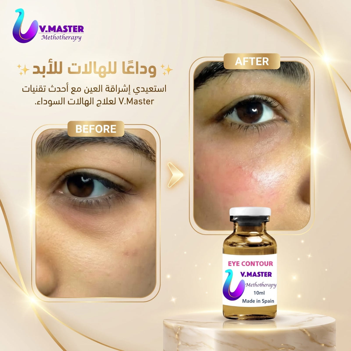 Eye contour